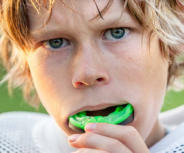 Mouthguards-in-The-Smile-Place