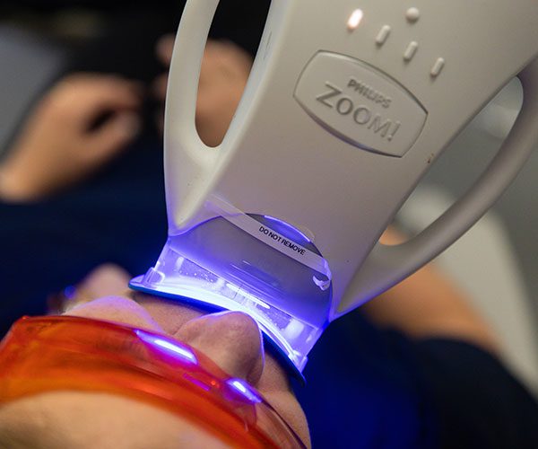 Philips Zoom in-chair whitening system used at The Smile Place